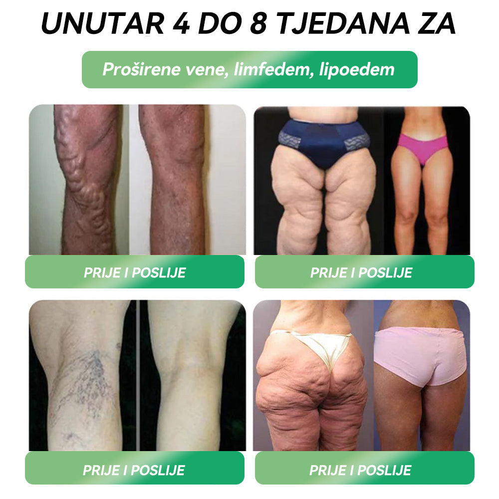 U skladu sa standardima HALMED-a🇬🇧 𝑆𝑇𝐷𝐸𝐼®  🔴𝐺𝐿𝑃-1𝑂𝑟𝑎𝑙𝑛𝑎 𝑜𝑡𝑜𝑝𝑖𝑛𝑎 𝑧𝑎 𝑚𝑟š𝑎𝑣𝑙𝑗𝑒𝑛𝑗𝑒 Pogodno za pretilost, kardiovaskularne probleme, dijabetes, apneju u snu, probleme sa zglobovima i još mnogo toga