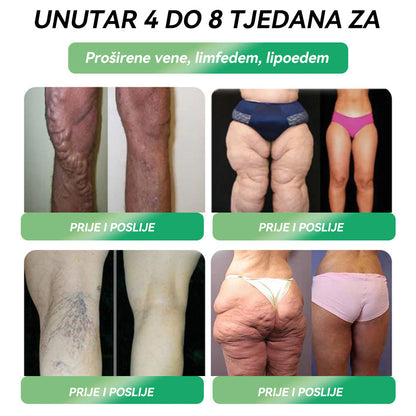 U skladu sa standardima HALMED-a🇬🇧 𝑆𝑇𝐷𝐸𝐼®  🔴𝐺𝐿𝑃-1𝑂𝑟𝑎𝑙𝑛𝑎 𝑜𝑡𝑜𝑝𝑖𝑛𝑎 𝑧𝑎 𝑚𝑟š𝑎𝑣𝑙𝑗𝑒𝑛𝑗𝑒 Pogodno za pretilost, kardiovaskularne probleme, dijabetes, apneju u snu, probleme sa zglobovima i još mnogo toga